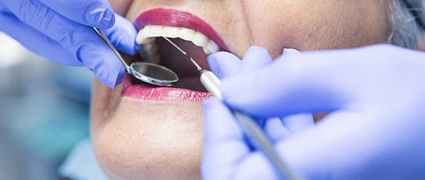 Best Emergency Dental Extractions in Emerd Mountain, AL